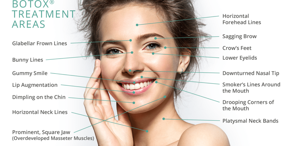 Botox Injections in KL, Selangor & Melaka - Stellar Clinic